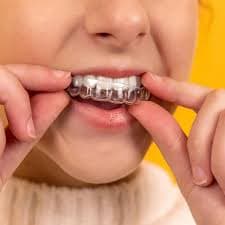 Ceramic Braces Care Tips for a Healthy and Beautiful Smile